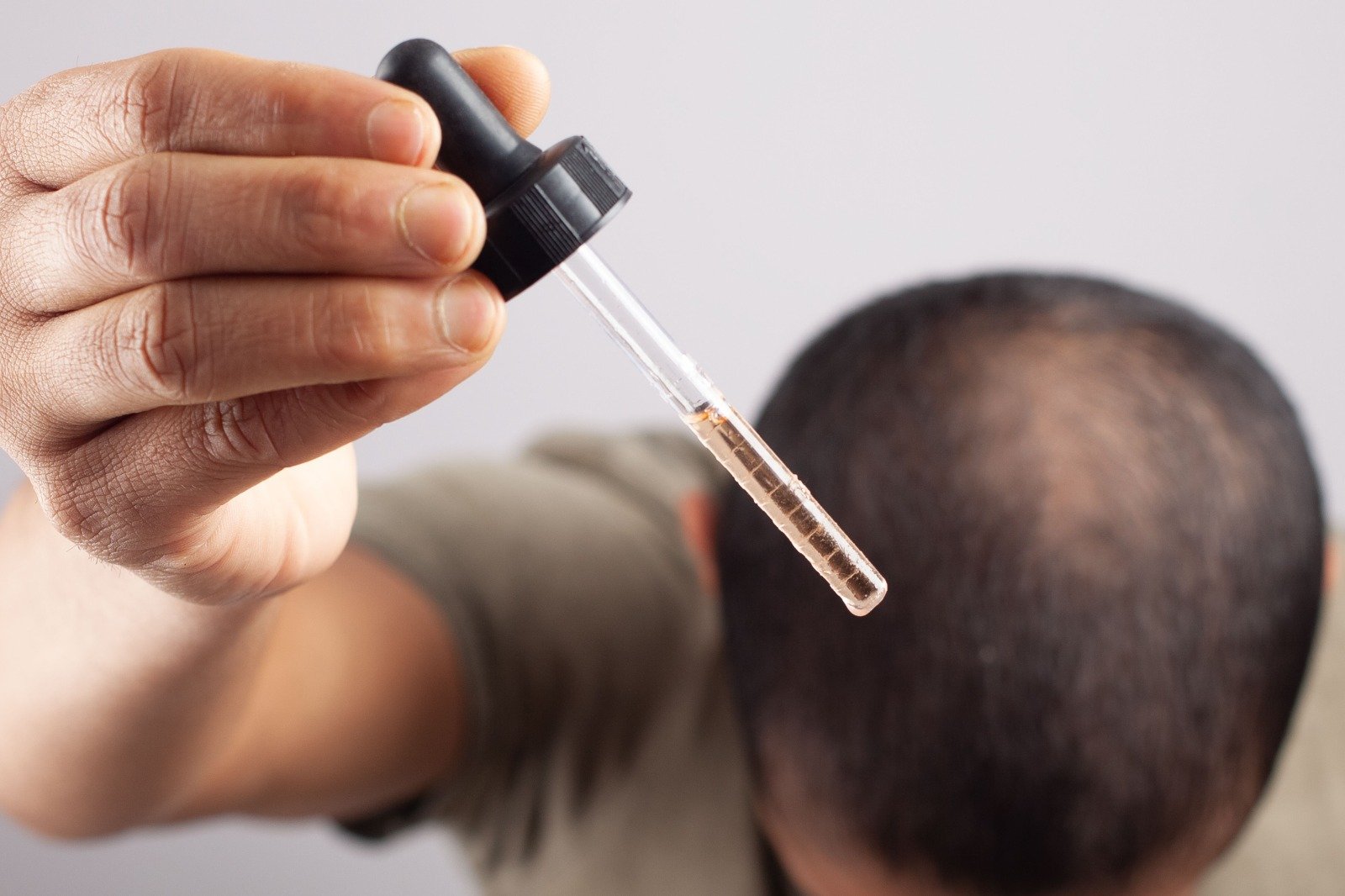 Telogen Effluvium Serum